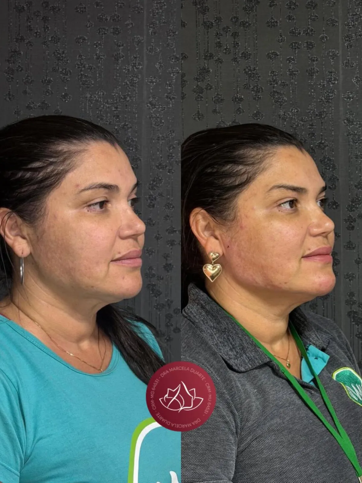 Equilíbrio e rejuvenescimento natural